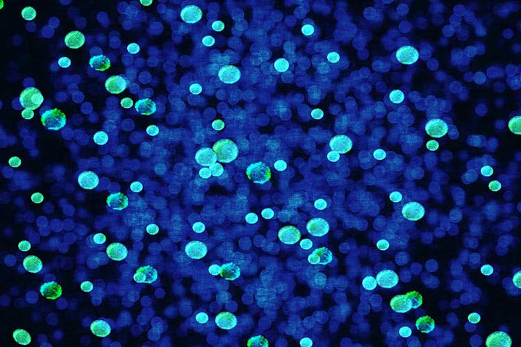 trimethoprim-allergy